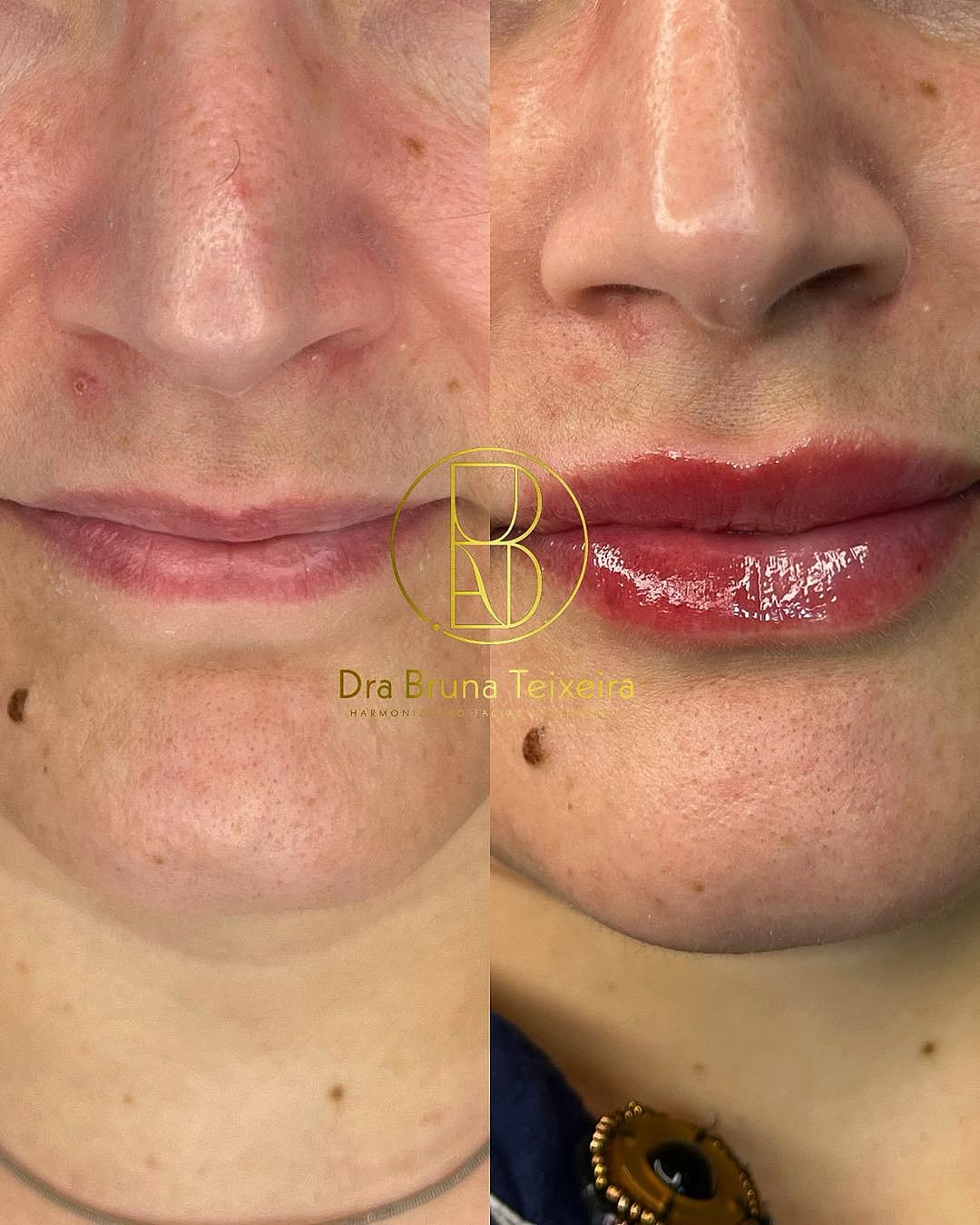 Foto interna do espaço da Clinica de Estética Agua Verde
